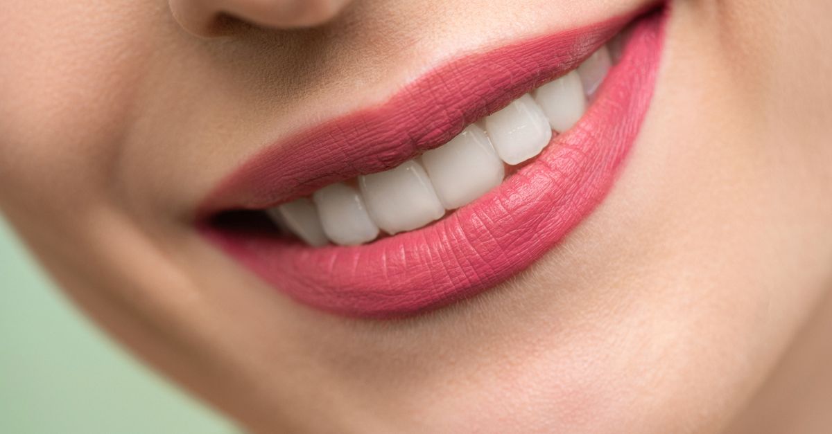 Vivid close-up image of a woman's smile showcasing red lipstick and white teeth on a light background.